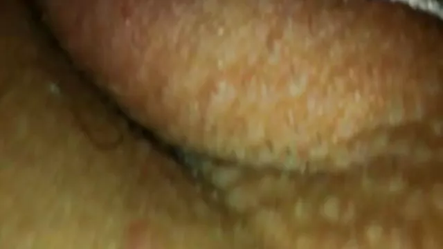 Upskirts